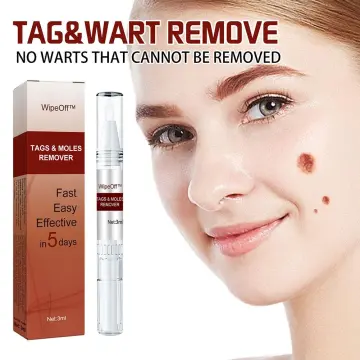 Skin Tag Remover Pen - Best Price in Singapore - Oct 2023